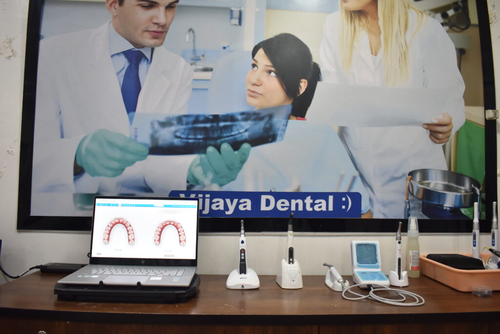 Best Invisalign Aligners in Hyderabad